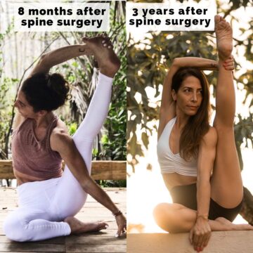 Cathy Madeo Yoga @cathymadeoyoga PROGRESS When I came out of spine